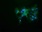 KEAP1 Antibody in Immunocytochemistry (ICC/IF)