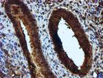 KEAP1 Antibody in Immunohistochemistry (Paraffin) (IHC (P))