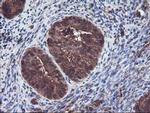 KEAP1 Antibody in Immunohistochemistry (Paraffin) (IHC (P))