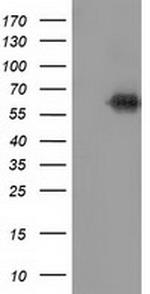 KEAP1 Antibody in Western Blot (WB)