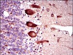 KEAP1 Antibody in Immunohistochemistry (Paraffin) (IHC (P))