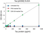 Human Tau (Phospho) [pS396] ELISA Kit