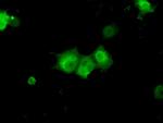 KHK Antibody in Immunocytochemistry (ICC/IF)