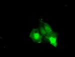 KHK Antibody in Immunocytochemistry (ICC/IF)