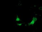 KHK Antibody in Immunocytochemistry (ICC/IF)