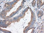 KHK Antibody in Immunohistochemistry (Paraffin) (IHC (P))