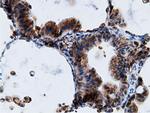 KHK Antibody in Immunohistochemistry (Paraffin) (IHC (P))