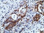 KHK Antibody in Immunohistochemistry (Paraffin) (IHC (P))