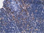 KHK Antibody in Immunohistochemistry (Paraffin) (IHC (P))