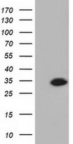 KHK Antibody in Western Blot (WB)