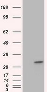 KHK Antibody in Western Blot (WB)