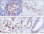 Ki-67 Antibody in Immunohistochemistry (Paraffin) (IHC (P))