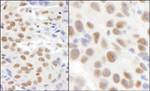 KIAA0082 Antibody in Immunohistochemistry (IHC)