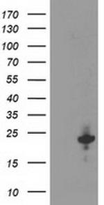 KIAA0495 Antibody in Western Blot (WB)