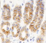 KIAA0528 Antibody in Immunohistochemistry (IHC)