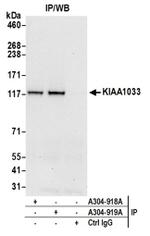 KIAA1033/WASH complex subunit 7 Antibody in Immunoprecipitation (IP)