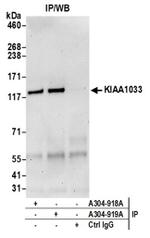 KIAA1033/WASH complex subunit 7 Antibody in Western Blot (WB)