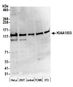 KIAA1033/WASH complex subunit 7 Antibody in Western Blot (WB)