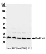 KIAA1143 Antibody in Western Blot (WB)