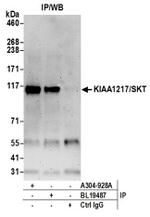 KIAA1217/SKT Antibody in Western Blot (WB)