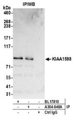 KIAA1598 Antibody in Western Blot (WB)