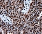 KIAA1609 Antibody in Immunohistochemistry (Paraffin) (IHC (P))