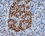 KIAA1609 Antibody in Immunohistochemistry (Paraffin) (IHC (P))