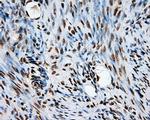 KIAA1609 Antibody in Immunohistochemistry (Paraffin) (IHC (P))