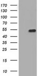 KIAA1609 Antibody in Western Blot (WB)