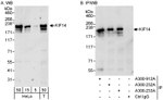 KIF14 Antibody in Western Blot (WB)