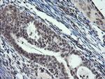 KIF25 Antibody in Immunohistochemistry (Paraffin) (IHC (P))