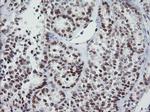 KIF25 Antibody in Immunohistochemistry (Paraffin) (IHC (P))