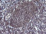 KIF25 Antibody in Immunohistochemistry (Paraffin) (IHC (P))