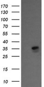 KIF25 Antibody in Western Blot (WB)