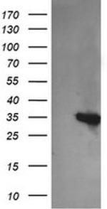 KIF25 Antibody in Western Blot (WB)