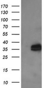 KIF25 Antibody in Western Blot (WB)