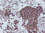 KIF2C Antibody in Immunohistochemistry (Paraffin) (IHC (P))