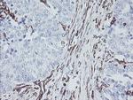 KIF2C Antibody in Immunohistochemistry (Paraffin) (IHC (P))