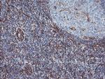 KIF2C Antibody in Immunohistochemistry (Paraffin) (IHC (P))