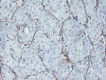 KIF2C Antibody in Immunohistochemistry (Paraffin) (IHC (P))