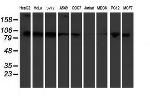 KIF2C Antibody in Western Blot (WB)