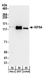 KIF5A Antibody in Western Blot (WB)