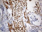 KIF6 Antibody in Immunohistochemistry (Paraffin) (IHC (P))