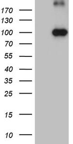 KIF6 Antibody in Western Blot (WB)