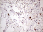 KIT Antibody in Immunohistochemistry (Paraffin) (IHC (P))