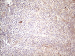 KIT Antibody in Immunohistochemistry (Paraffin) (IHC (P))