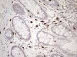 KIT Antibody in Immunohistochemistry (Paraffin) (IHC (P))