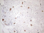 KIT Antibody in Immunohistochemistry (Paraffin) (IHC (P))