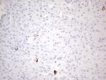 KIT Antibody in Immunohistochemistry (Paraffin) (IHC (P))