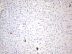 KIT Antibody in Immunohistochemistry (Paraffin) (IHC (P))